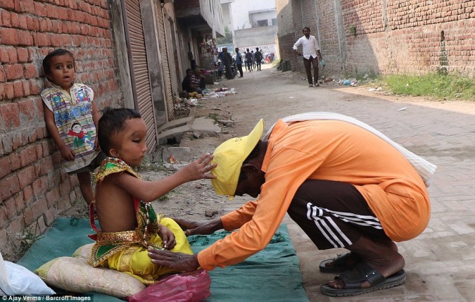 В индийской деревне поклоняются мальчику с деформированной головой