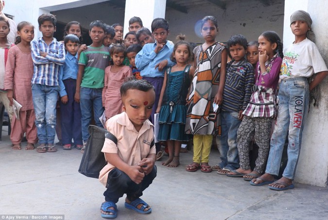 В индийской деревне поклоняются мальчику с деформированной головой