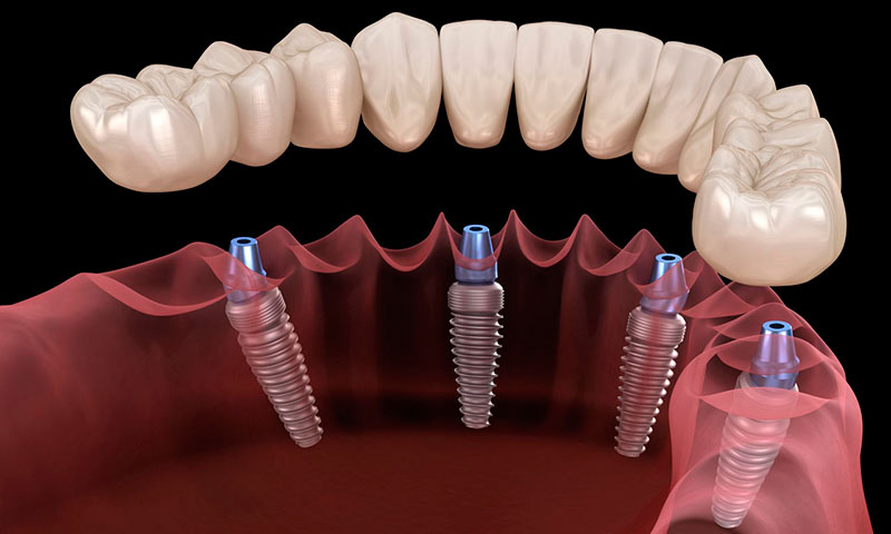 Стоматологические и зуботехнические материалы